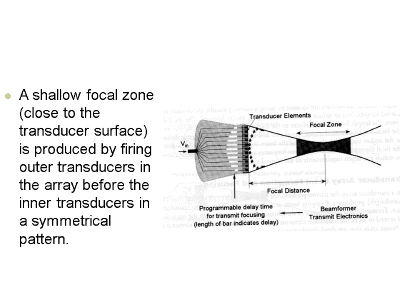 A shallow focal zone (close to the transducer surface) is produced by firing outer